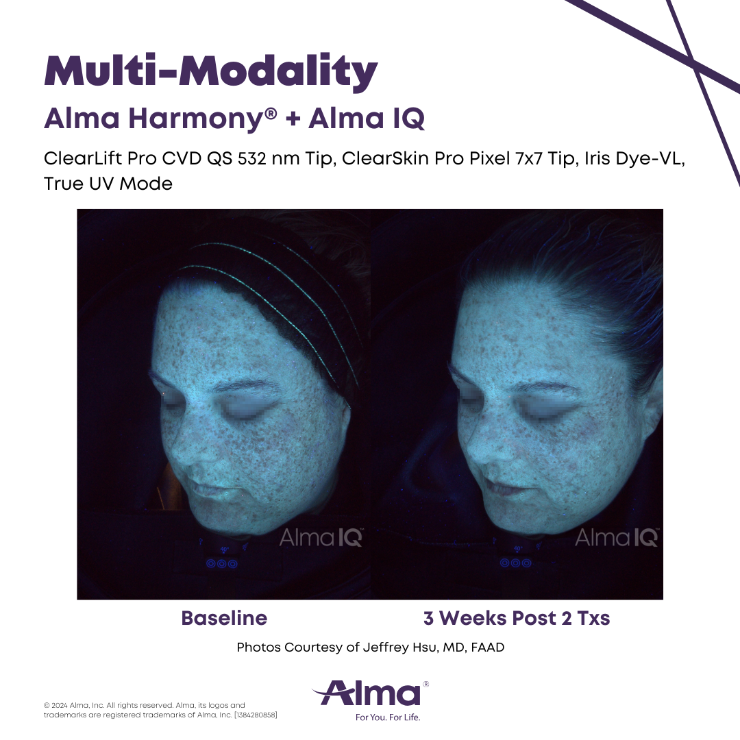 Alma Harmony_Alma IQ_B&A_J.Hsu_Q1-24_1384280858_canva